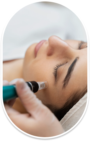 Nano Needling