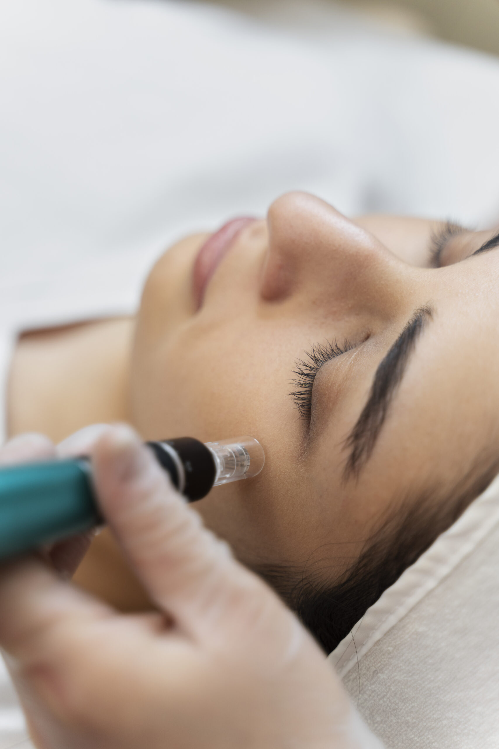 Pro Nano-Needling