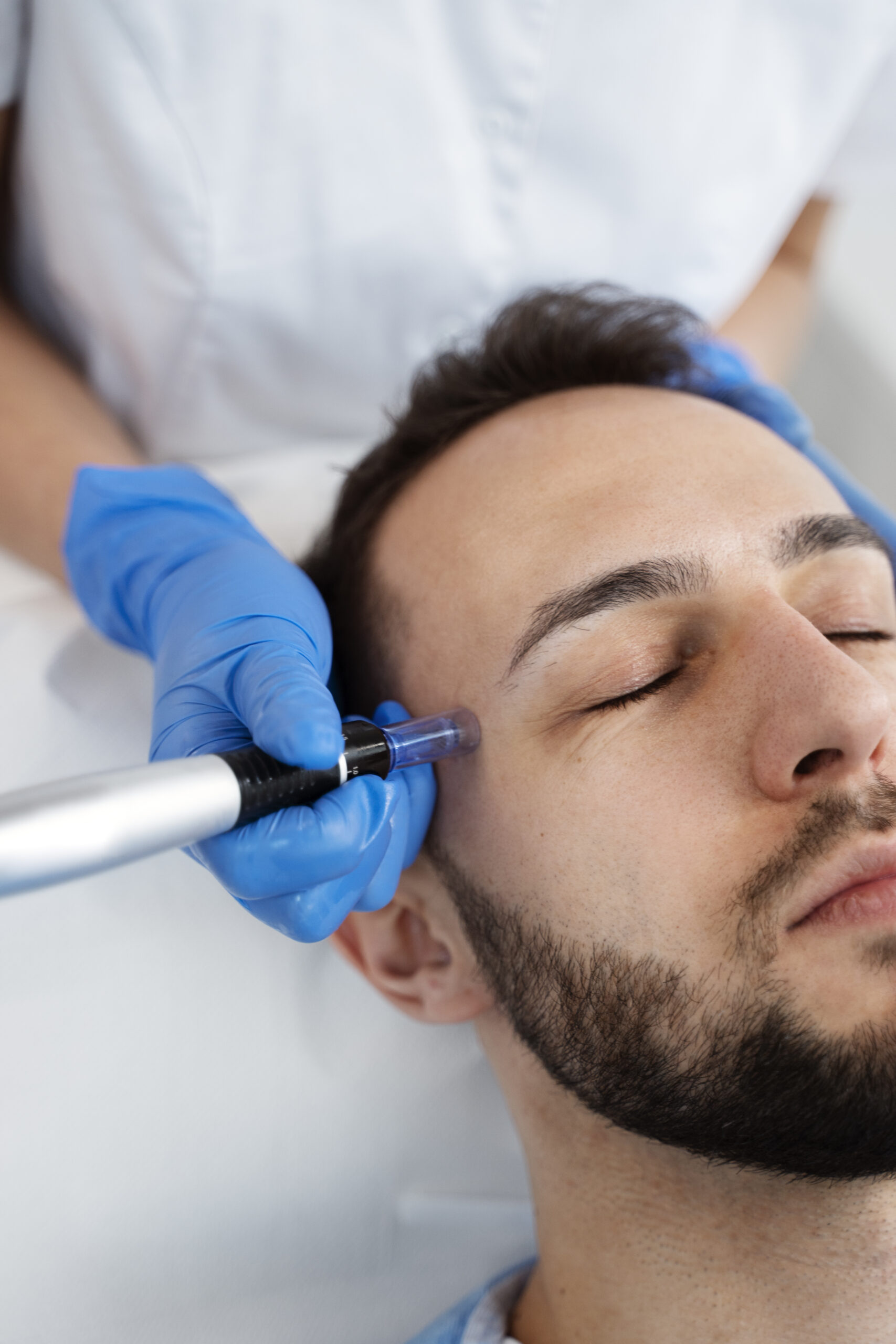 Pro Nano-Needling