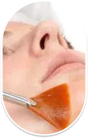 Peeling Pro Power Peel
